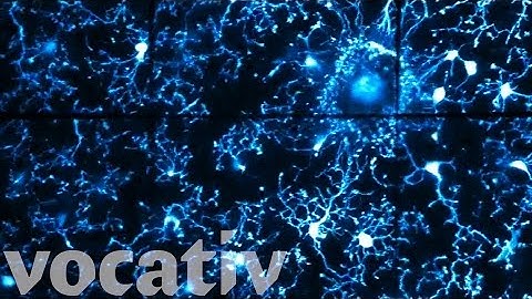 This Is A Mouse Brain At Work