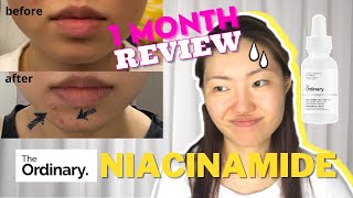 Trying The Ordinary Niacinamide 10 + Zinc 1 | 1 Month Honest Review Yay or Nah?