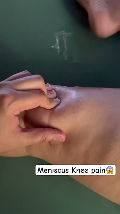 You Won't Believe this Meniscus Knee Pain 😱 #shorts