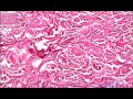 Dense Irregular Mp4 Dense Irregular Mp4