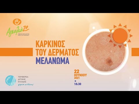 ΑγκαλιάΖΩ | Καρκίνος του δέρματος | Μελάνωμα