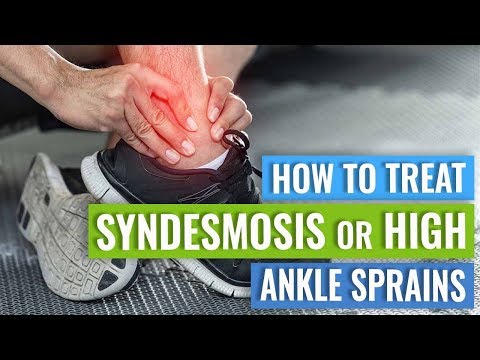 Syndesmosis or High Ankle Sprain Treatment