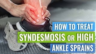 Syndesmosis or High Ankle Sprain Treatment