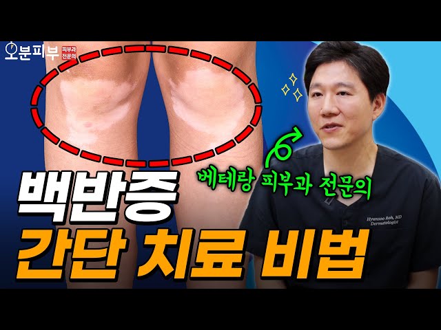 피부 위에 흰 반점이 생겼다면?
