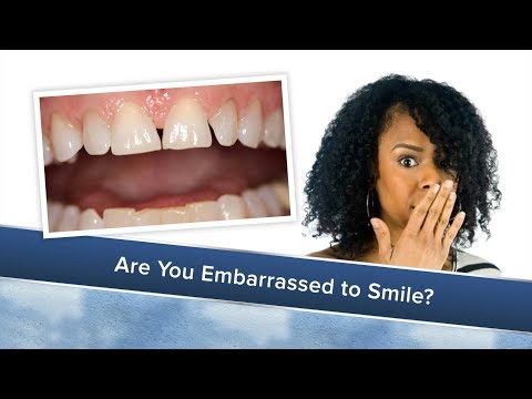 How to Improve Your Smile
