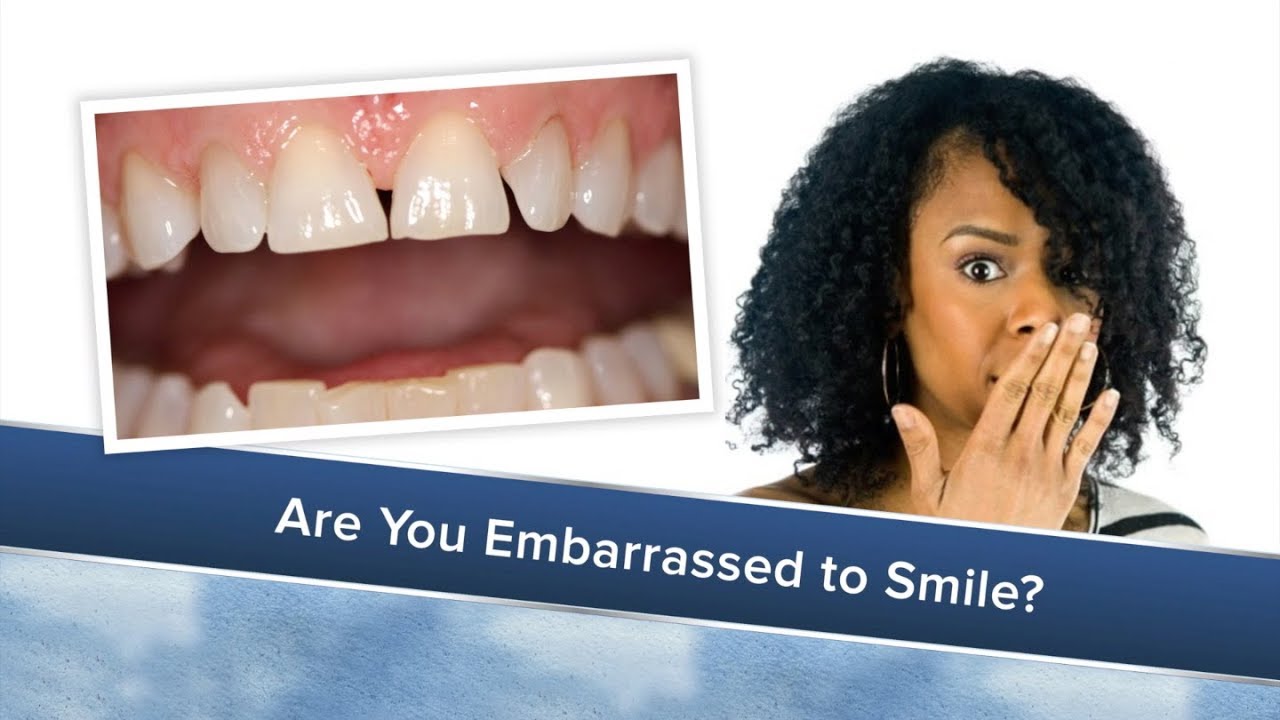 How to Improve Your Smile - YouTube