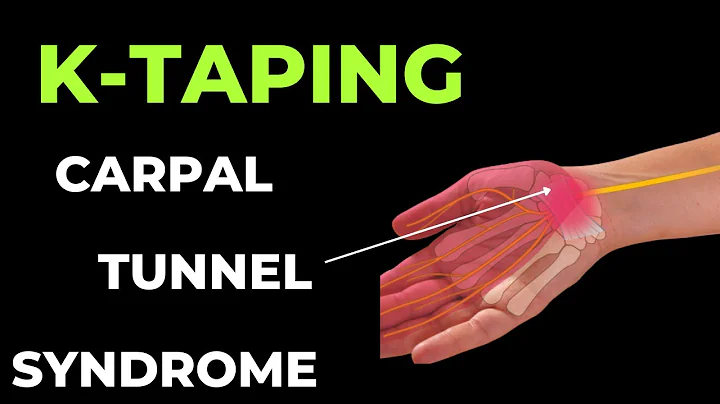 How to treat Carpal Tunnel Syndrome using Kinesiology Tape