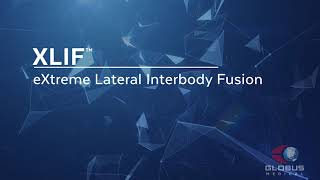 Extreme Lateral Interbody Fusion (XLIF) - Patient Animation