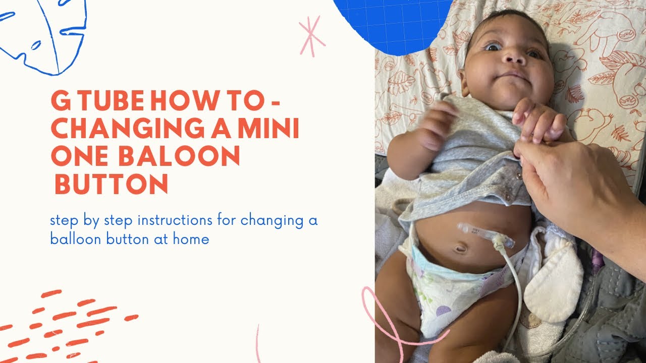 How to| Changing a mini one g tube button at home - please read disclaimer in description box