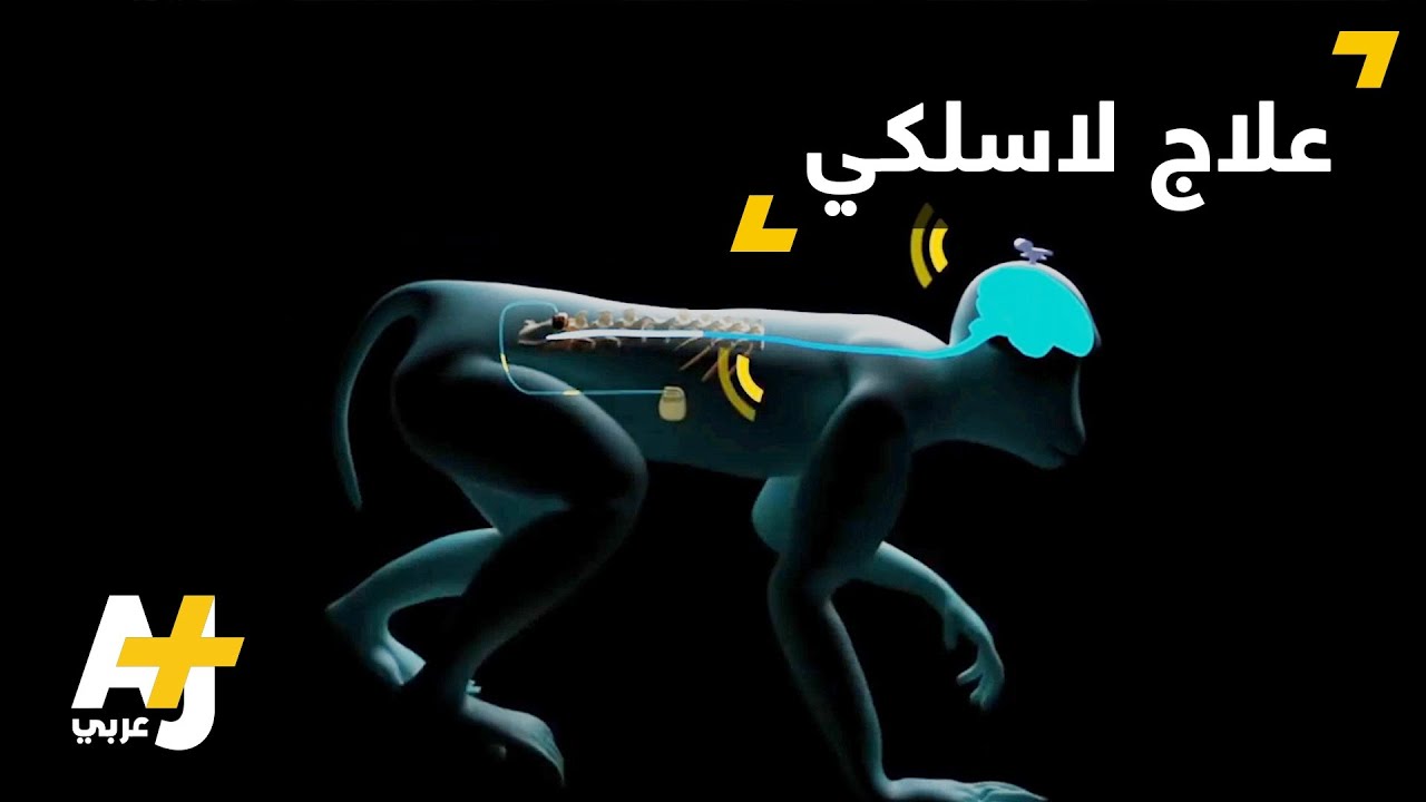 علماء سويسريون ينجحون في علاج قردة من الشلل