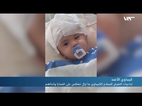 تداعيات التعرض للسلاح الكيماوي ما تزال تنعكس على الضحايا وأبنائهم