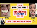 कितने IMPORTANT हैं दांत MARRIAGE जैसे ISSUE के लिए ??-LIFE CHANGING VID-Patient's Emotional reviews