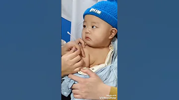 دكتور بيدي لطفل ابره شوفه الطفل عمل اية Baby Cute 