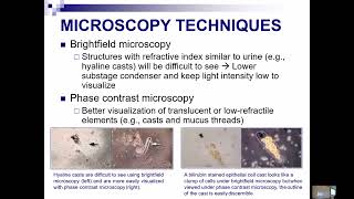 UA Lecture 8 Microscopic Exam of Urine Part 1