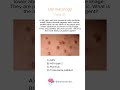 Dermatology - Case 51