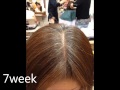 ドクタースカルプ　ITAKURA