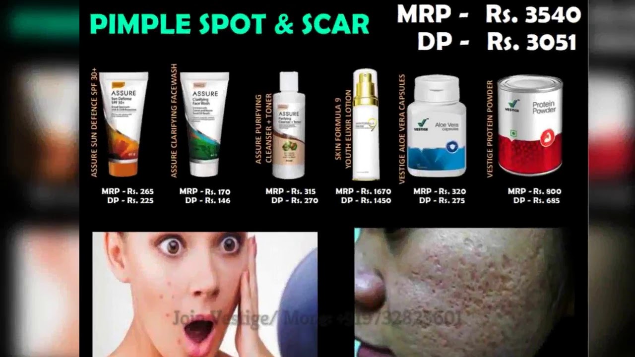 vestige pigmentation cream