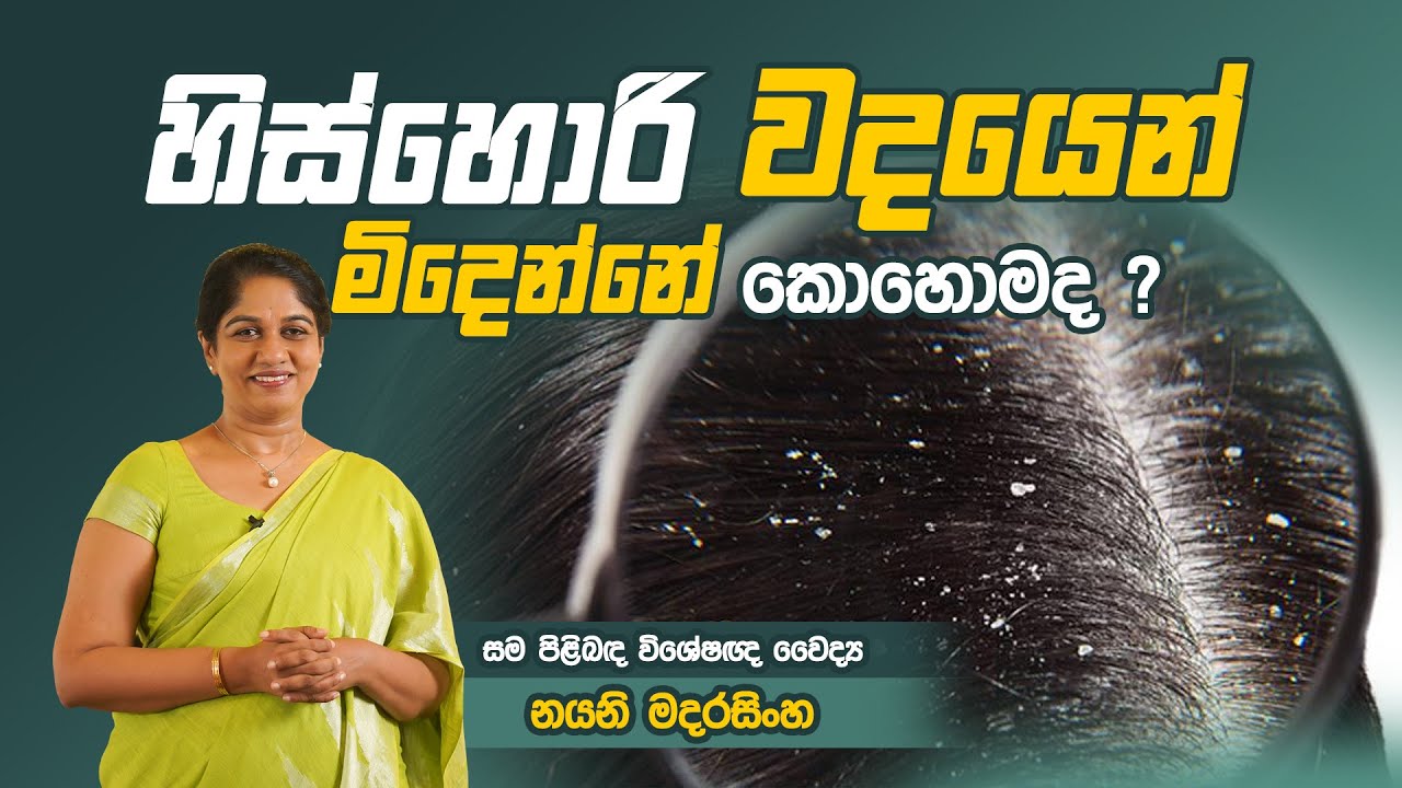 ඉස්හොරි වලට විසදුම් | Dandruff Treatments in Sinhala | Dr Nayani Madarasinghe