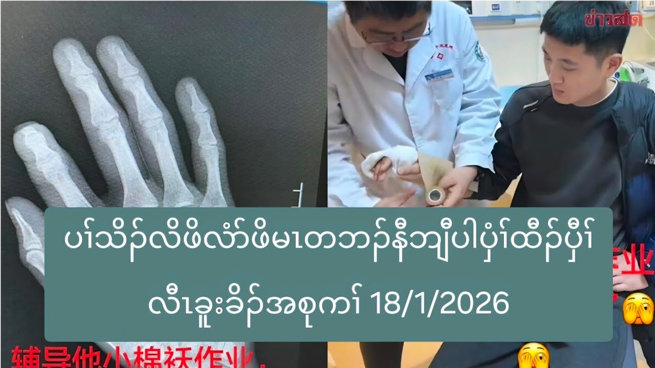 ပၢ်သိၣ်လိဖိလံာ်ဖိမၤတဘၣ်နီဘျီပါပှံၢ်ထီၣ်ပှီၢ်လီၤခူးခိၣ်အစုကၢ် 18/1/2026