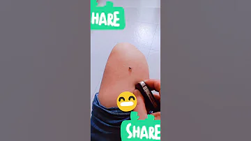 صيد الذباب المزعج 