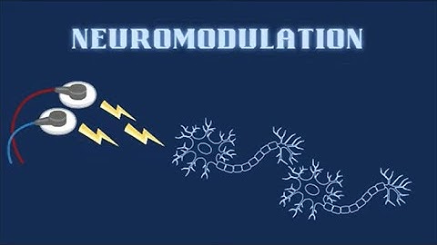 Neuromodulation: The Development of a New Frontier