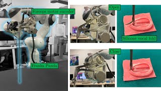 Robotic Tele-Operation for Upper Aerodigestive Tract Microsurgery: System Design and Validation