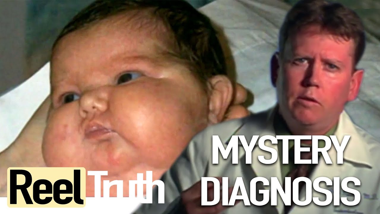Baby Mysteriously Gains Weight