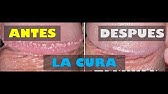 para que sirven las glandulas de tyson