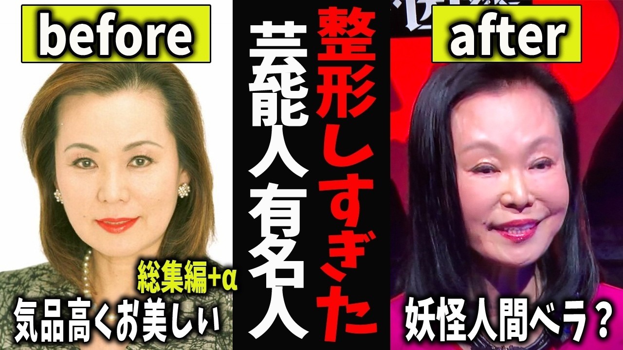【ガルちゃん芸能】整形しすぎた芸能人・有名人 総集編5【有益2ch】