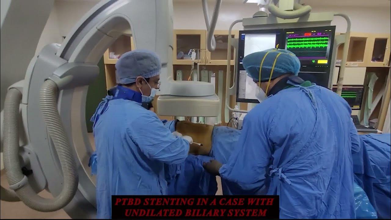 PTBD Stenting in a Case with Undilated Biliary System irfacilities 
