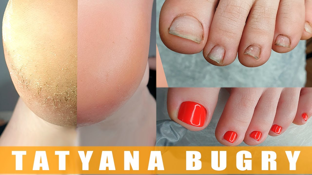 Transformation Pedicure | Summer Pedicure | Russian, Efile Pedicure