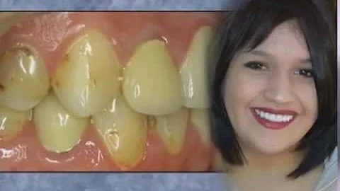 Financial District Dental: Dr. Raymond Hahn is a S...