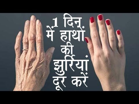 वीडियो: अपनी उंगलियों की घरेलू देखभाल