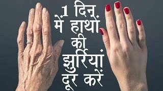 Remove Wrinkles Of Hands With This Remedy & Make Hands Soft And Young / Wrinkle Free Hands screenshot 3