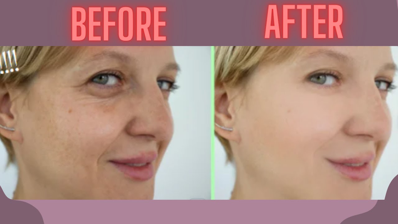 9 BEST HERBS FOR SKIN TIGHTENING AND ANTIAGING YouTube