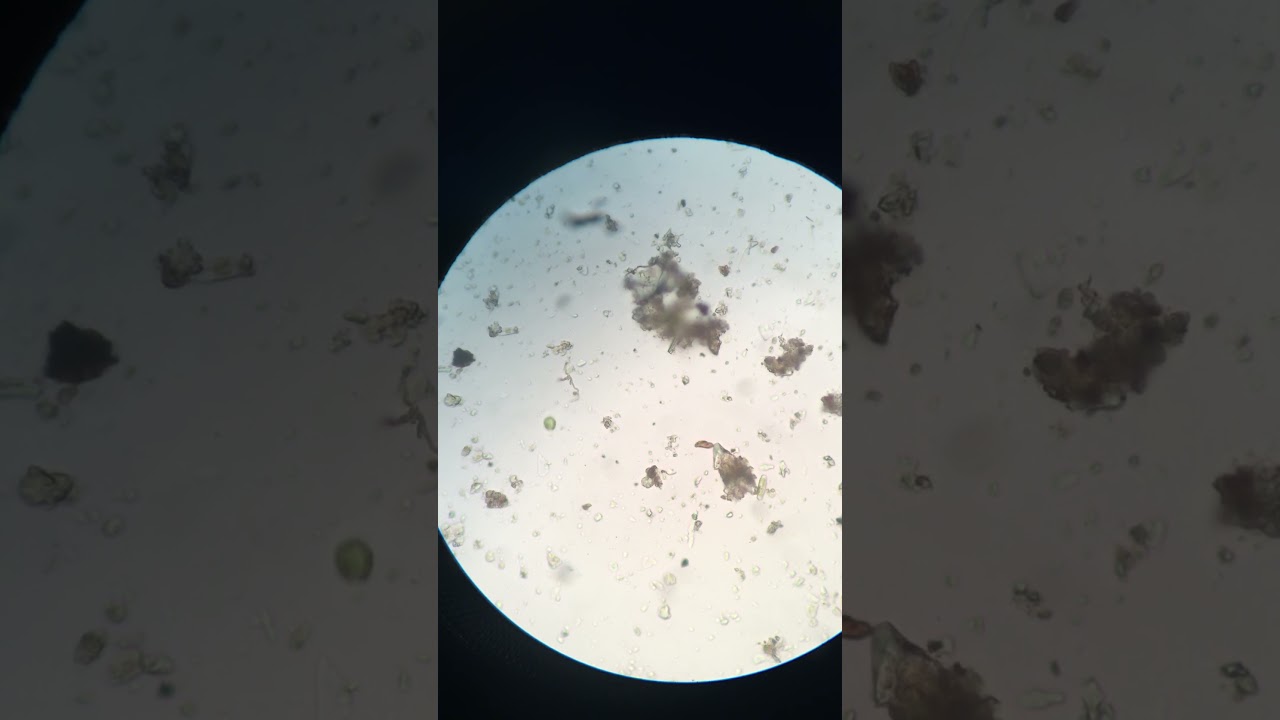 Pond Water Under a Microscope YouTube