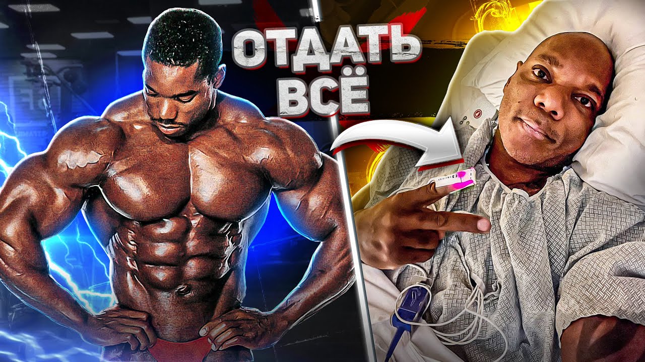 КОРОЛЬ ЭСТЕТИКИ, ПОТЕРЯВШИЙ НОГУ / Флекс Уиллер