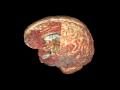 Мозг человека: поверхность и срез