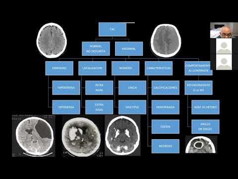 Vídeo: Neuroimagen Funcional Y Corea: Una Revisión Sistemática