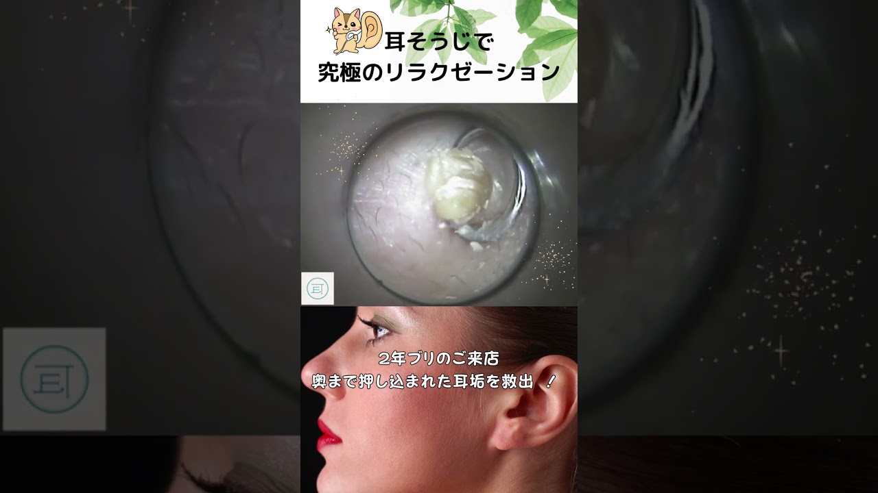 奥まで押し込まれた耳垢を救出! #イヤーエステ #耳掃除 #eariss #イヤーエステ #耳掃除 #耳かき動画 #耳美人クリエーター