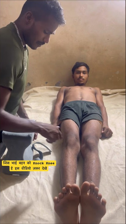 Knock Knee से कैसे छुटकारा पाये #shorts #viral #motivational #video #indianarmy #sscgd #knock #knee