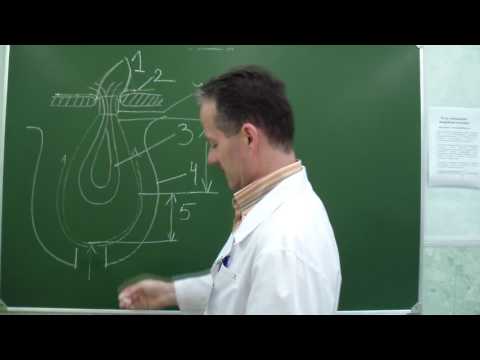Элементы грыжи. Этапы грыжесечения