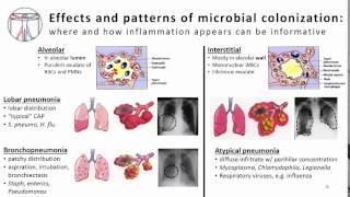 1. Pnuemonia Pathophysiology and Clin Presentation