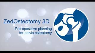 ZedOsteotomy 3D
