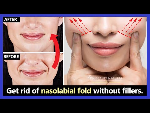 Best easy way!! How to get rid of nasolabial folds, laugh lines naturally (without fillers, botox)