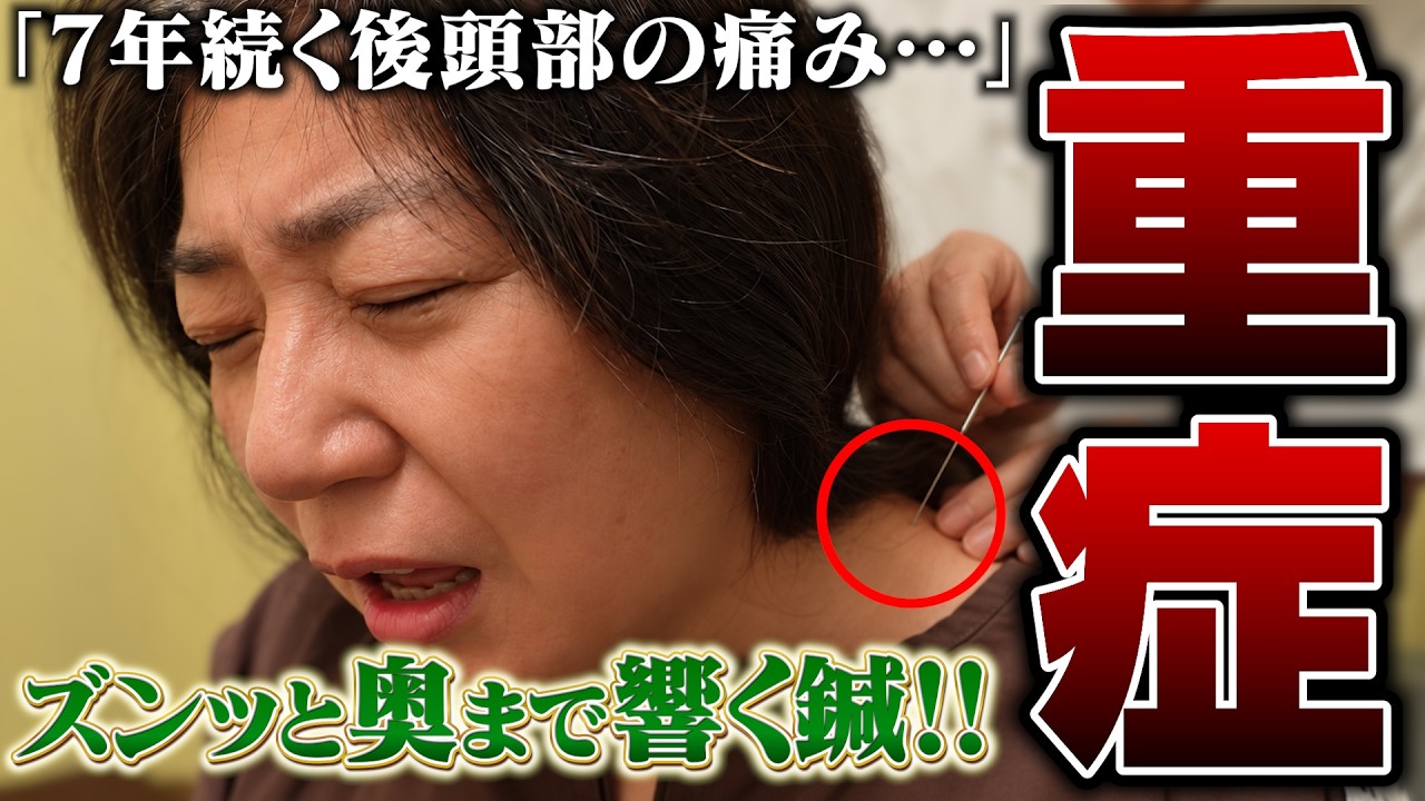 Occipital symptoms in a woman with long hair - YouTube
