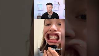 She Did Her OWN Braces! 😳🦷