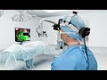 The evolved arveo 8 digital visualization microscope for neurosurgery