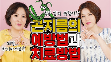 "성기사마귀" 일명 "곤지름"(condyloma 콘딜로마) 제발❗ 영상보시고 바로❗ 치료해주세요!!!