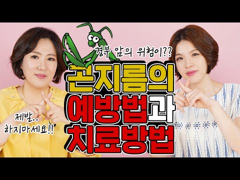 "성기사마귀" 일명 "곤지름"(condyloma 콘딜로마) 제발❗ 영상보시고 바로❗ 치료해주세요!!!